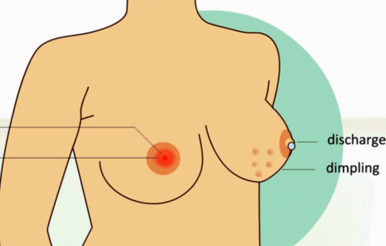 Imoko-itukura-696x349
